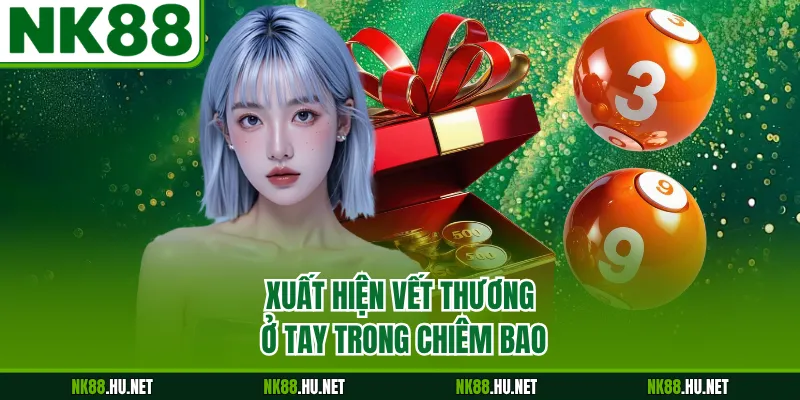Xuất hiện vết thương ở tay trong chiêm bao